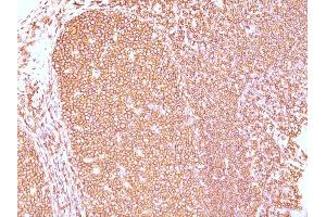 Formalin-fixed, paraffin-embedded human Tonsil stained with CD45RB Mouse Monoclonal Antibody (PD7/26). (CD45 Antikörper)