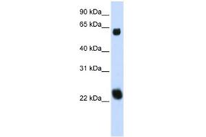 WB Suggested Anti-KLHL26 Antibody Titration:  0. (KLHL26 Antikörper  (Middle Region))