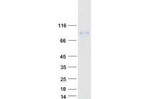 Western Blotting (WB) image for Hematopoietic Cell-Specific Lyn Substrate 1 (HCLS1) protein (Myc-DYKDDDDK Tag) (ABIN2722465)