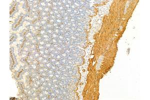 ABIN6254917 and ABIN6267068 at 1/100 staining Rat colon tissue by IHC-P. (alpha-SMA (N-Term) Antikörper)