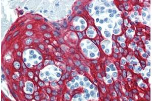 Tonsil, Human: Formalin-Fixed, Paraffin-Embedded (FFPE) (KRT14 Antikörper  (C-Term))