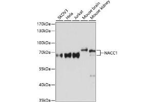 Western blot analysis of extracts of various cell lines, using N Antibody (ABIN6132231, ABIN6144337, ABIN6144339 and ABIN6215418) at 1:3000 dilution. (NAC1 Antikörper  (AA 170-340))