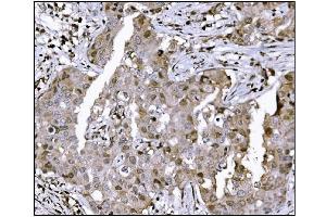 IHC analysis of KMT1B/SUV39H2 using anti-KMT1B/SUV39H2 antibody (ABIN7602135). (SUV39H2 Antikörper  (AA 6-410))