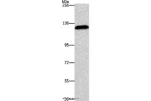Western blot analysis of Hela cell, using AGAP2 Polyclonal Antibody at dilution of 1:700 (AGAP2 Antikörper)