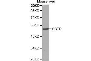 Western Blotting (WB) image for anti-Secretin Receptor (SCTR) antibody (ABIN3017416) (SCTR Antikörper)