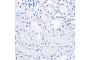 Immunohistochemistry of paraffin-embedded mouse kidney using SMEK1 Rabbit pAb (ABIN6130699, ABIN6148130, ABIN6148131 and ABIN6224584) at dilution of 1:100 (40x lens). (SMEK1 Antikörper  (AA 395-594))
