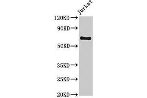 Western Blot Positive WB detected in: Jurkat whole cell lysate All lanes: GNL1 antibody at 3. (GNL1 Antikörper  (AA 251-500))