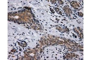 Immunohistochemical staining of paraffin-embedded breast tissue using anti-SIL1 mouse monoclonal antibody. (SIL1 Antikörper)