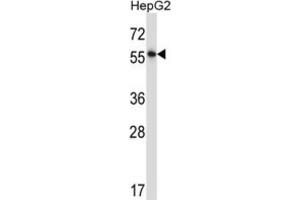 Western Blotting (WB) image for anti-Nuclear Factor I/A (NFIA) antibody (ABIN2997755) (NFIA Antikörper)