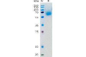 Human K Protein, hFc Tag on SDS-PAGE under reducing condition.