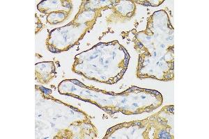 Immunohistochemistry of paraffin-embedded human placenta using Placental alkaline phosphatase (PLAP) antibody (ABIN6127420, ABIN6136826, ABIN6136827 and ABIN6221966) at dilution of 1:100 (40x lens). (PLAP Antikörper  (AA 260-460))