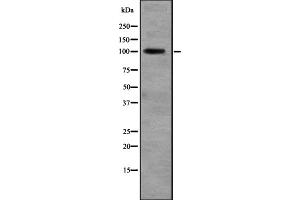 Western blot analysis of RALGDS expression in Liver (Human) Tissue Lysate ,The lane on the left is treated with the antigen-specific peptide. (RALGDS Antikörper  (N-Term))