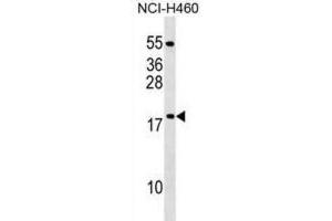 Western Blotting (WB) image for anti-Mitochondrial Ribosomal Protein L54 (MRPL54) antibody (ABIN2999653) (MRPL54 Antikörper)