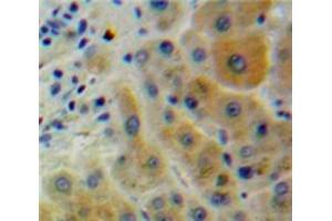 Used in DAB staining on fromalin fixed paraffin-embedded Liver tissue (CD2AP Antikörper  (AA 149-429))
