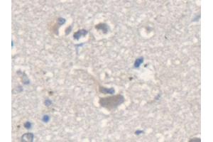 Detection of ME2 in Human Cerebrum Tissue using Polyclonal Antibody to Malic Enzyme 2, NADP+ Dependent, Mitochondrial (ME2) (Malic Enzyme 2, NADP+ Dependent, Mitochondrial (AA 220-426) Antikörper)