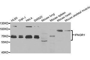 Western blot analysis of extracts of various cell lines, using IFNGR1 antibody (ABIN5973372) at 1/1000 dilution. (IFNGR1 Antikörper)
