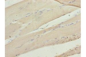 Immunohistochemistry of paraffin-embedded human skeletal muscle tissue using ABIN7146719 at dilution of 1:100 (CA3 Antikörper  (AA 2-260))