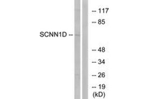 Western Blotting (WB) image for anti-Sodium Channel, Nonvoltage-Gated 1, delta (SCNN1D) (AA 411-460) antibody (ABIN2890112) (SCNN1D Antikörper  (AA 411-460))