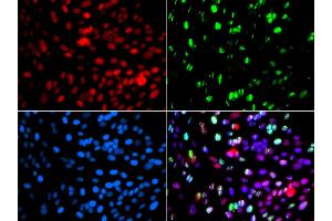 Immunofluorescence analysis of GFP-RNF168 transgenic U2OS cells using POLD3 antibody (ABIN5974362). (POLD3 Antikörper)