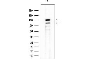 anti-FER Tyrosine Kinase (FER) antibody