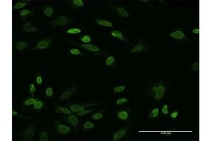 Immunofluorescence of monoclonal antibody to NHS on HeLa cell. (Nhs Antikörper  (AA 1532-1629))