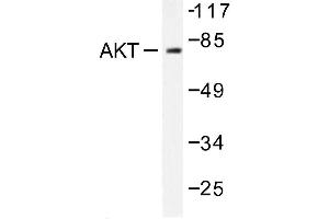 Image no. 1 for anti-V-Akt Murine Thymoma Viral Oncogene Homolog 1 (AKT1) antibody (ABIN271988) (AKT1 Antikörper)