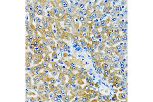 Immunohistochemistry of paraffin-embedded rat liver using HD antibody (ABIN6133742, ABIN6141675, ABIN6141678 and ABIN6213911) at dilution of 1:100 (40x lens). (HDAC5 Antikörper  (AA 550-650))