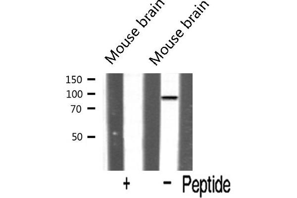 HSPH1 Antikörper  (C-Term)