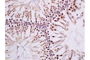 Formalin-fixed and paraffin embedded rat testis tissue labeled with Rabbit Anti-MAK (Tyr159) Polyclonal Antibody, Unconjugated (ABIN2559531) at 1:200 followed by conjugation to the secondary antibody and DAB staining (MAK Antikörper  (pTyr159))