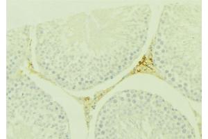 Immunohistochemistry (IHC) image for anti-Wingless-Type MMTV Integration Site Family, Member 7A (WNT7A) (Internal Region) antibody (ABIN6266046)