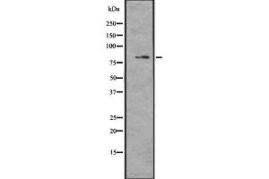 Western blot analysis of MAGD4 expression in U373 cell lysate;,The lane on the left is treated with the antigen-specific peptide. (MAGED4B Antikörper  (Internal Region))