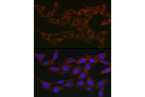 Immunofluorescence analysis of NIH/3T3 cells using WNK3 Rabbit pAb (ABIN7271382) at dilution of 1:200 (40x lens). (WNK3 Antikörper  (AA 500-600))