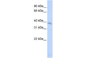 WB Suggested Anti-TMEM82 Antibody Titration:  0. (TMEM82 Antikörper  (N-Term))