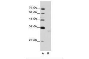 Image no. 1 for anti-Exosome Component 6 (EXOSC6) (N-Term) antibody (ABIN6736212) (EXOSC6 Antikörper  (N-Term))
