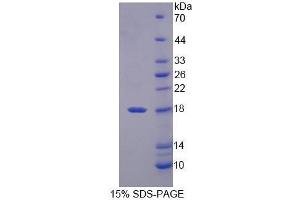 SDS-PAGE (SDS) image for Defensin, alpha 3, Neutrophil-Specific (DEFa3) (AA 21-94) protein (His tag) (ABIN1079357) (DEFa3 Protein (AA 21-94) (His tag))