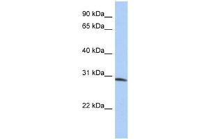 WB Suggested Anti-ZFYVE28 Antibody Titration:  0. (ZFYVE28 Antikörper  (N-Term))