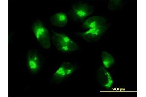 Immunofluorescence of purified MaxPab antibody to ACBD3 on HeLa cell.