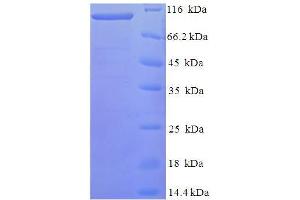 SDS-PAGE (SDS) image for Family with Sequence Similarity 160, Member B1 (FAM160B1) (AA 1-738), (Isoform 2) protein (His-SUMO Tag) (ABIN5711409)