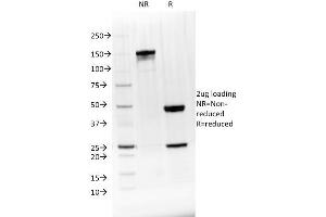 SDS-PAGE Analysis Purified BTLA Mouse Monoclonal Antibody (BTLA/1528).