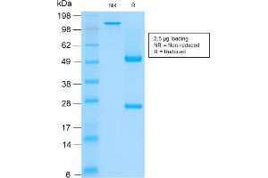 SDS-PAGE Analysis of Purified CK HMW Mouse Recombinant Monoclonal Antibody (rKRTH/2148). (Rekombinanter Cytokeratin 2 Antikörper)