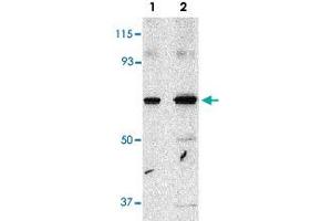 Western blot analysis of PAK4 in SW480 cell lysate with PAK4 polyclonal antibody  at 1 and 2 ug/mL .