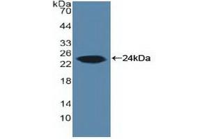 Western Blotting (WB) image for anti-Cytochrome P450, Family 19, Subfamily A, Polypeptide 1 (CYP19A1) (AA 196-373) antibody (ABIN7434818)