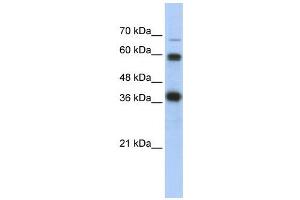 WB Suggested Anti-NRF1  Antibody Titration: 0. (NRF1 Antikörper  (N-Term))