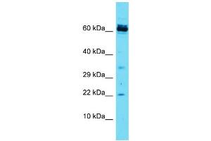 Host: Rabbit Target Name: CCDC115 Sample Type: Jurkat Whole Cell lysates Antibody Dilution: 1. (CCDC115 Antikörper  (N-Term))