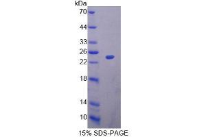 SDS-PAGE analysis of Rat MRPL1 Protein. (MRPL1 Protein)