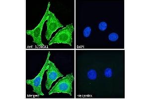 ABIN2613478 Immunofluorescence analysis of paraformaldehyde fixed HeLa cells, permeabilized with 0. (SLC40A1 Antikörper  (AA 245-259))