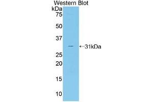 Western blot analysis of the recombinant protein. (CNTF Receptor alpha Antikörper  (AA 120-358))