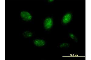 Immunofluorescence of purified MaxPab antibody to MYB on HeLa cell.