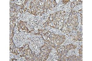 IHC analysis of HSPD1 using anti-HSPD1 antibody (ABIN7600976).