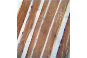 Immunohistochemistry (Paraffin-embedded Sections) (IHC (p)) image for anti-NADH Dehydrogenase (Ubiquinone) 1 alpha Subcomplex, 11, 14.7kDa (NDUFA11) (AA 71-100), (Middle Region) antibody (ABIN953629)